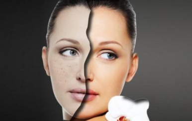 簡單的祛痘方法，讓你的皮膚時刻光滑細嫩